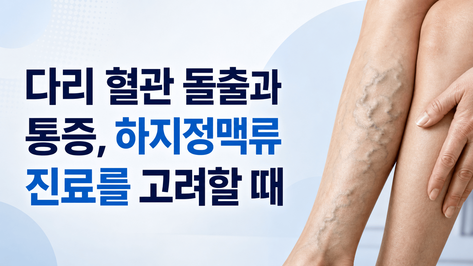 다리 혈관 돌출과 통증, 하지정맥류 진료를 고려할 때