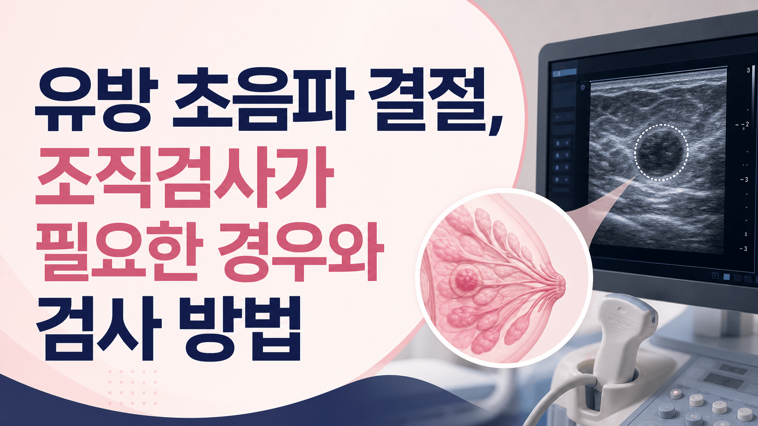 유방 초음파 결절, 조직검사가 필요한 경우와 검사 방법