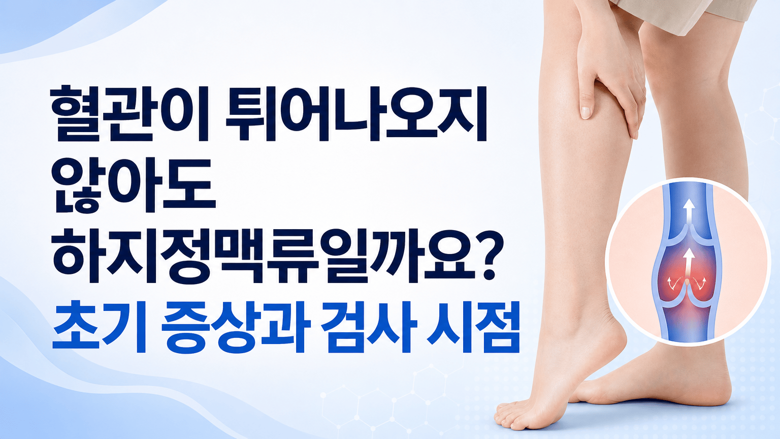 혈관이 튀어나오지 않아도 하지정맥류일까요? 초기 증상과 검사 시점