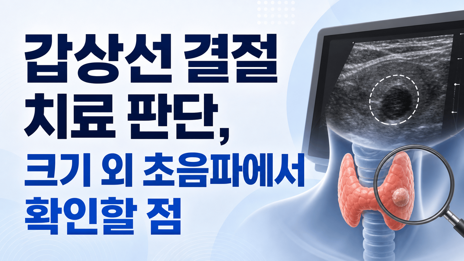 갑상선 결절 치료 판단, 크기 외 초음파에서 확인할 점